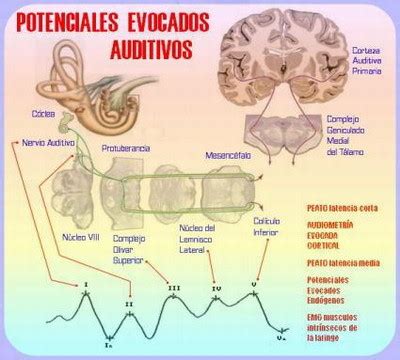 Diagrama explicando los Potenciales Evocados Auditivos de Tronco Cerebral Automatizados (PEATC-A)