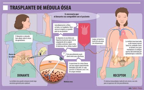 Gráfico comparativo de tasas de supervivencia en trasplantes de médula ósea con donantes relacionados vs. no relacionados.