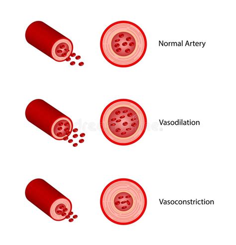 Infografía mostrando los mecanismos de vasodilatación y vasoconstricción