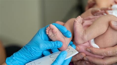 Foto de un profesional de la salud realizando la prueba del talón a un recién nacido