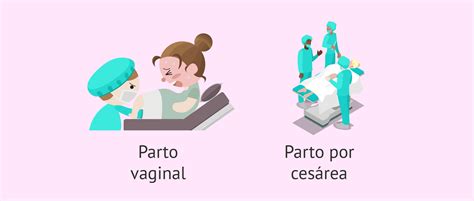 Infografía comparativa de las opciones de parto (vaginal vs. cesárea) en casos de corioamnionitis.