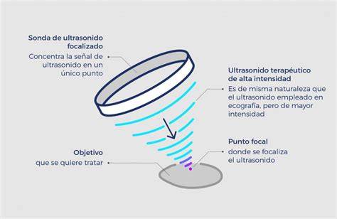 Esquema explicativo sobre el funcionamiento de los ultrasonidos en el diagnóstico prenatal y sus aplicaciones clínicas.