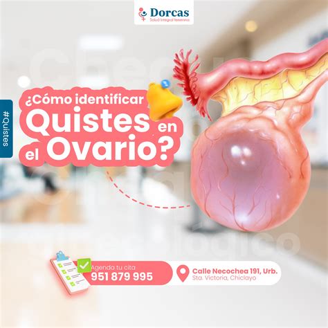 Mujer en consulta ginecológica discutiendo la prevención de quistes ováricos.