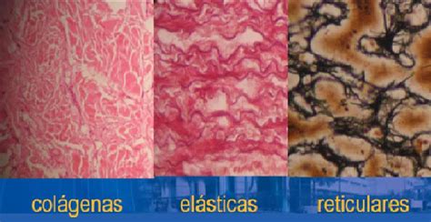 Microfotografía mostrando las fibras colágenas, elásticas y reticulares dentro de la matriz del tejido conectivo.