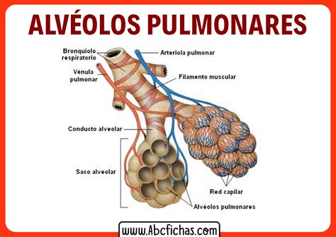 Esquema de alvéolos pulmonares sanos vs. colapsados en SDRN con o sin surfactante