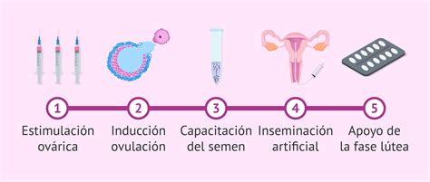 Esquema explicativo del proceso de inseminación artificial intrauterina desde la estimulación ovárica hasta la introducción del semen