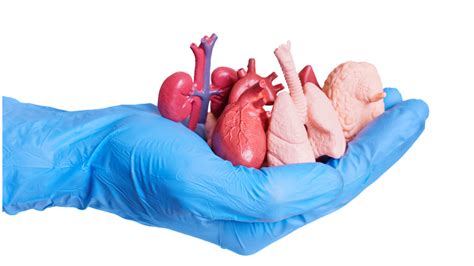 Esquema de un trasplante de útero, mostrando las conexiones vasculares y la anatomía relevante.