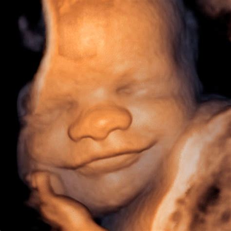 Ecografía 4D mostrando el desarrollo y movimiento fetal en tiempo real