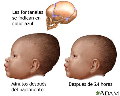 Esquema explicativo sobre los puntos de tratamiento en un recién nacido: cabeza, columna y pelvis.
