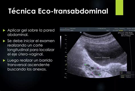 Esquema visual que muestra las diferencias entre vía abdominal y transvaginal en la ecografía temprana