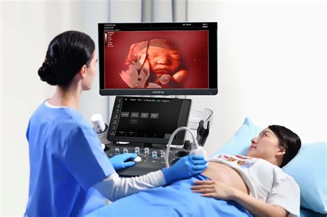 Esquema general que muestra la aplicación de ultrasonido en diferentes especies animales durante el control gestacional.