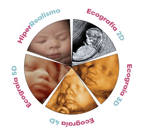 Infografía comparativa de las ecografías 4D y 5D