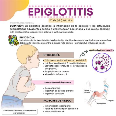Representación gráfica de los síntomas de la epiglotitis en un niño