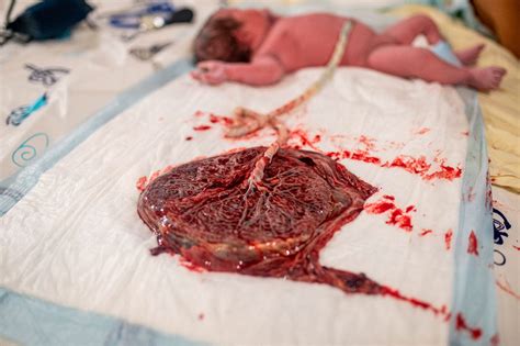 foto de cápsulas de placenta