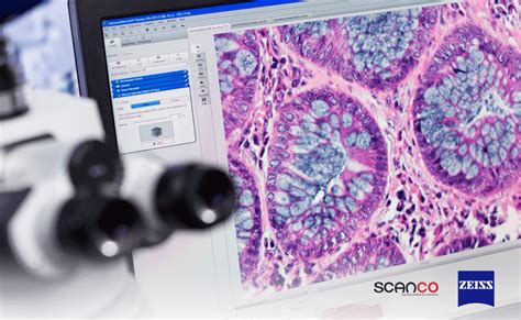 Imagen de microscopía detallando una ovicela (cámara de incubación) en una colonia de briozoos.