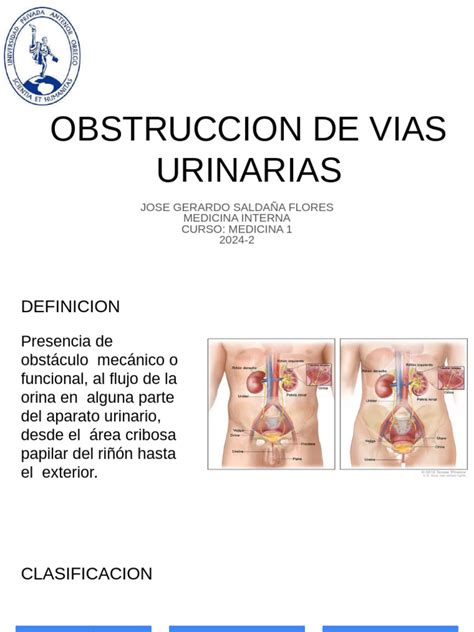 Esquema de las vías urinarias fetales con obstrucción