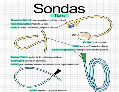 Dibujo técnico de diferentes tipos de sondas de muestreo: sonda de cámara, extractor parcial y sonda abierta.