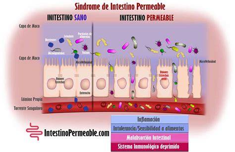 Ilustración del intestino sano y con síndrome de intestino permeable