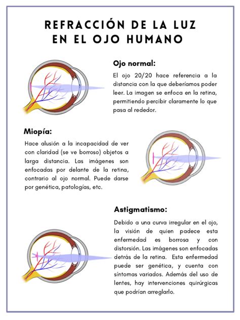 Esquema del ojo mostrando la refracción de la luz y cómo una imagen nítida llega a la retina