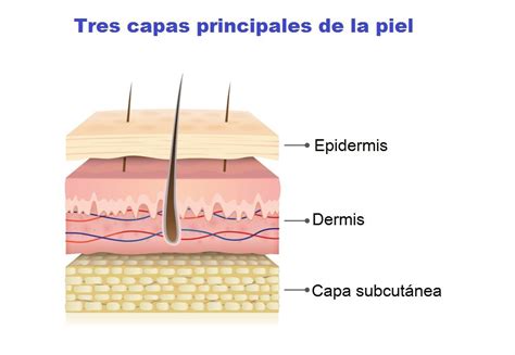 Esquema de las capas de la piel con un lunar (nevus)