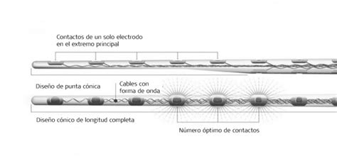 Esquema comparativo de guías de electrodos cortas vs. largas en la cóclea y su impacto en la percepción de frecuencias bajas