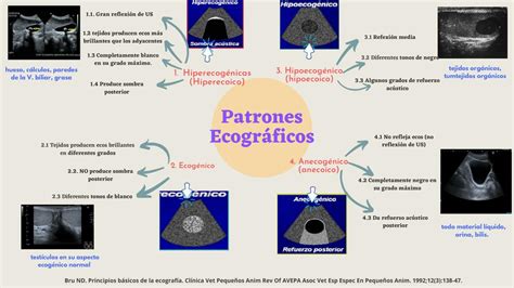 Esquema de los diferentes patrones ecográficos de torsión ovárica