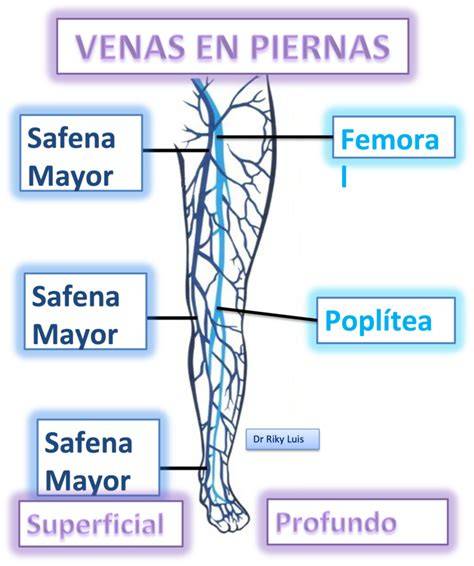 Esquema de las venas de la pierna mostrando un trombo