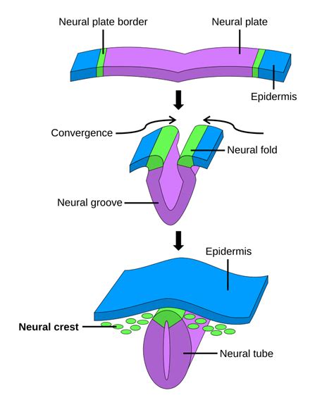 Diagrama que ilustra el proceso de plegamiento de la placa neural en el desarrollo embrionario y cómo puede ocurrir la absorción de un embrión por otro.
