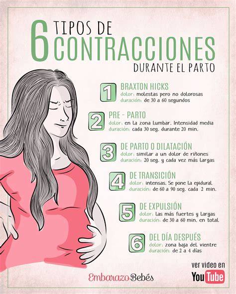 Esquema comparativo de los distintos tipos de parto