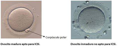 Micrografías comparativas de ovocitos maduros (MII) e inmaduros (MI, VG)
