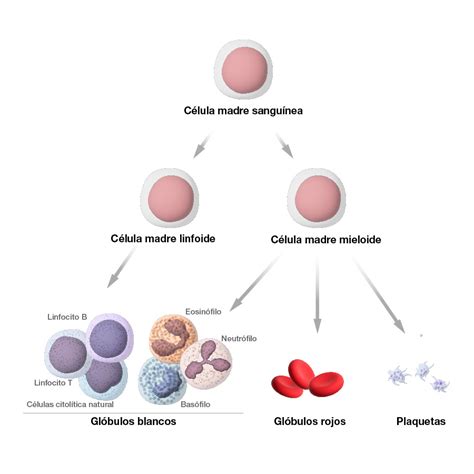 Diagrama que muestra los diferentes tipos de células sanguíneas y cómo la leucemia afecta su producción en la médula ósea.