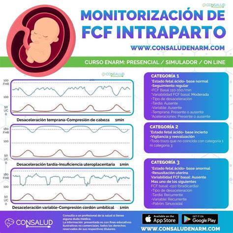 Infografía comparativa de métodos de vigilancia fetal intraparto: CTG, muestreo de sangre fetal y oximetría de pulso fetal.
