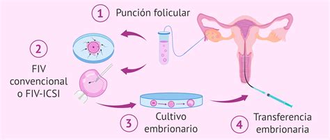 Ilustración que muestra las diferentes etapas de la Fecundación in Vitro (FIV) y la Inseminación Artificial (IA).