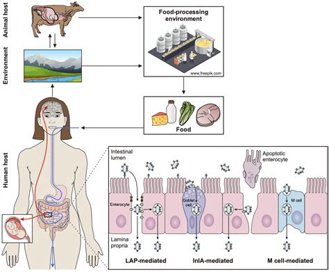 Infografía: Rutas de transmisión de Listeria monocytogenes al feto y al neonato