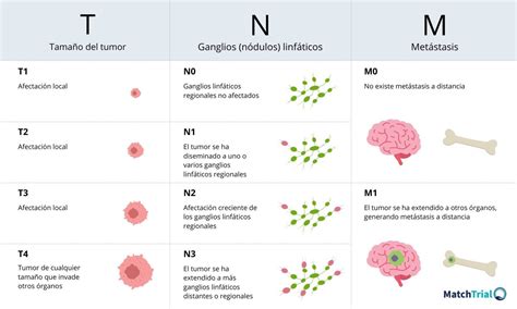 Tabla que ilustra los diferentes estadios del cáncer de mama según el sistema TNM
