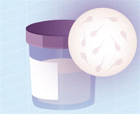 Ilustración de una muestra de semen para inseminación artificial