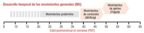 Gráfico mostrando la evolución de los movimientos generales del bebé (writhing, fidgety) y su correlación con el pronóstico neurológico.
