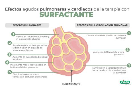Esquema de alvéolos pulmonares inmaduros y con deficiencia de surfactante