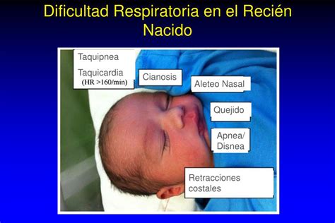 Infografía: Signos de dificultad respiratoria en neonatos (taquipnea, retracciones, cianosis, aleteo nasal)