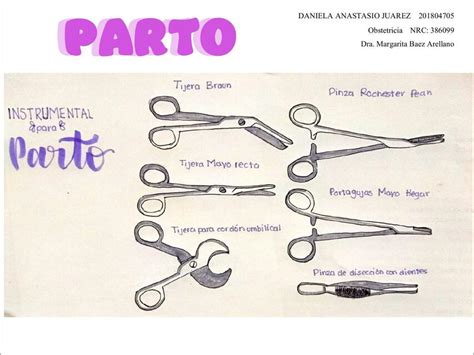 Esquema de las herramientas utilizadas en un parto instrumental, mostrando fórceps y ventosa obstétrica