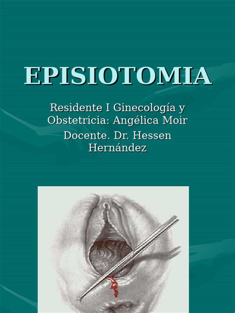Infografía sobre las consecuencias a largo plazo de una episiotomía con complicaciones.