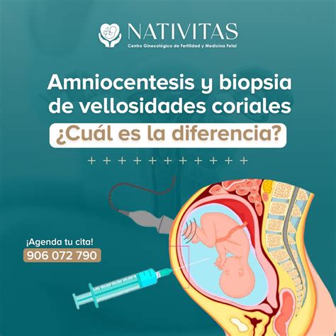 Infografía comparativa entre CVS y amniocentesis: momento de realización, tipos de anomalías detectadas y riesgos.