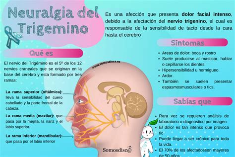 infografía detallando los síntomas y el diagnóstico de neuralgia