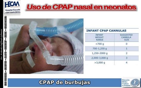 Esquema detallado de un sistema de CPAPn adaptado para la administración de heliox en neonatos