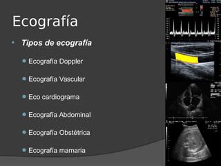 Infografía que resume los diferentes tipos de ecografías obstétricas y sus principales características.