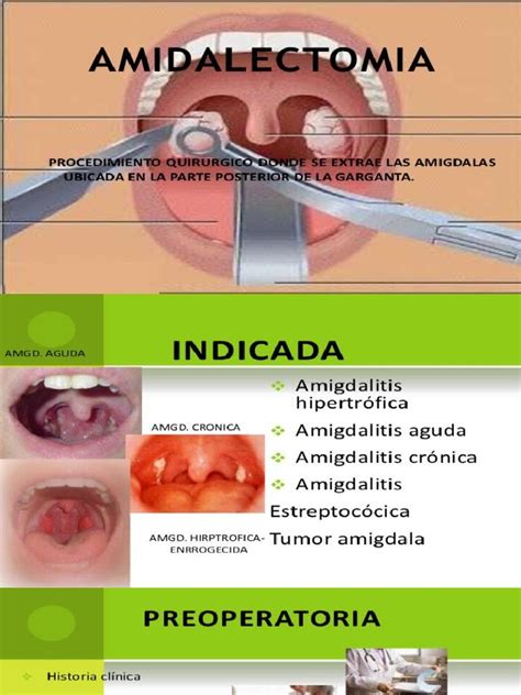 Ilustración de la sala de operaciones durante una amigdalectomía o adenoidectomía