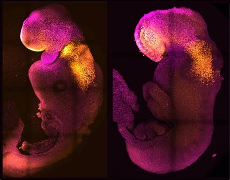 Microfotografía de un embrión quimérico de ratón con células humanas rsPSCs marcadas