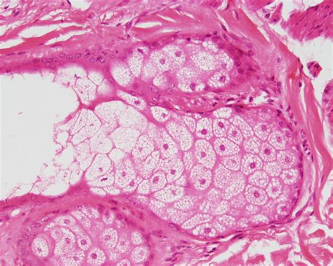 Micrografía de células mucosas y serosas en un acino glandular con tinción de hematoxilina-eosina
