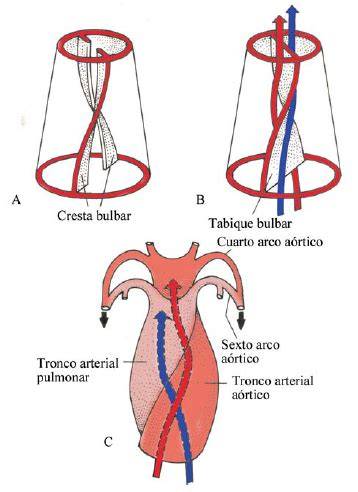 Ilustración de la tabicación del tronco arterioso y cono, mostrando la formación de las arterias aorta y pulmonar y la posible ocurrencia de defectos.