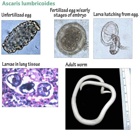 Ilustración de Ascaris lumbricoides adulto, mostrando su forma cilíndrica y extremos puntiagudos.